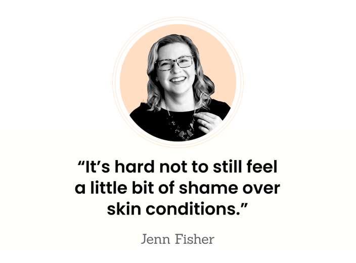 This is a headshot of Jenn Fisher, taken indoors. “When it’s your baby, your perfect little brand-new wonder, it’s hard not to still feel a little bit of shame over skin conditions.” — Jenn Fisher