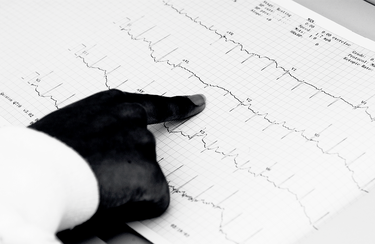 Health: Heart Attack: GettyImages-128930561
