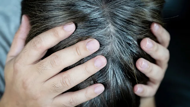 Hair: Stress and gray hairs: holding head stress gray roots 1317196506