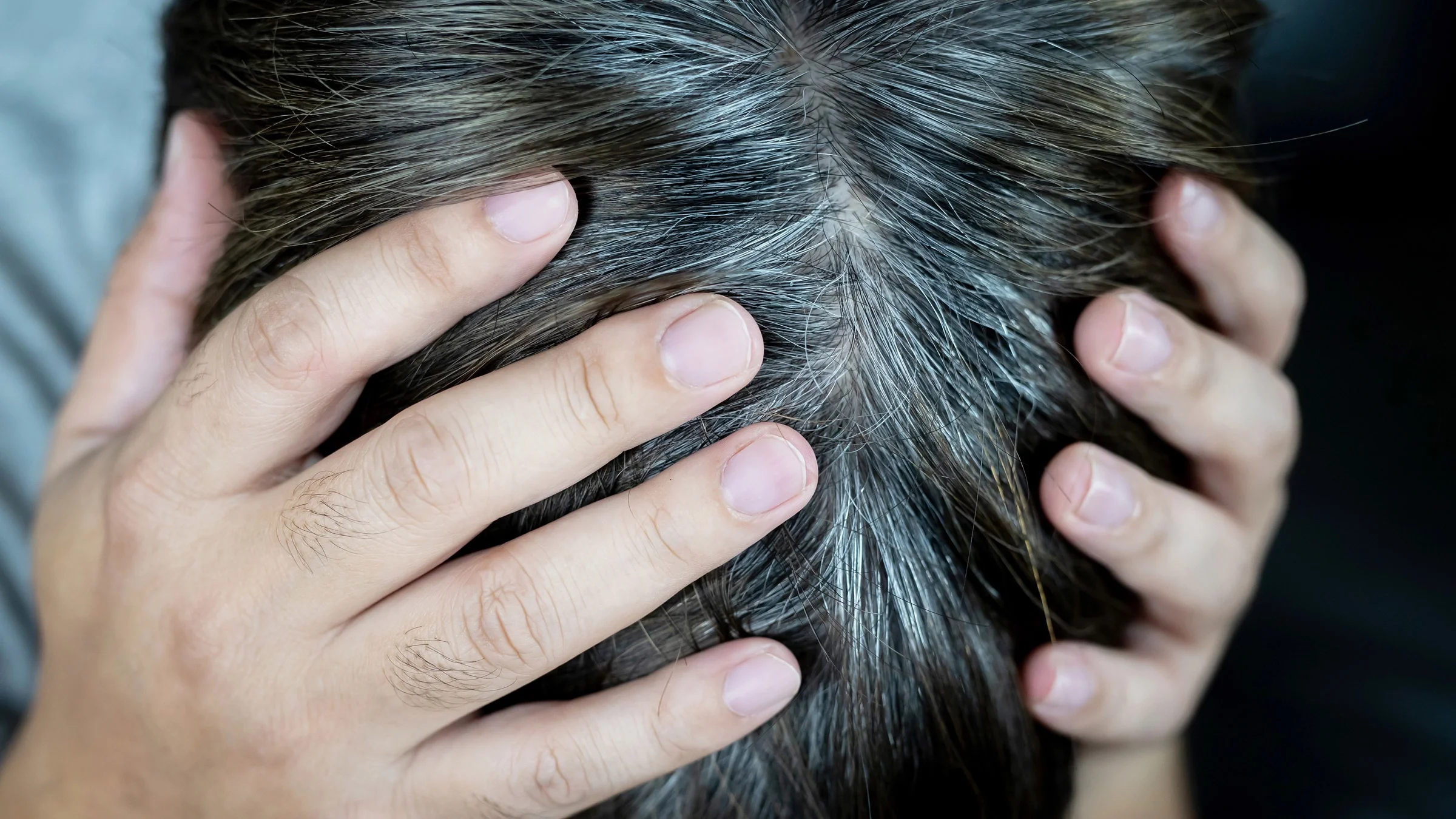 A close-up of a person holding their head out of stress. There are gray roots growing in.
