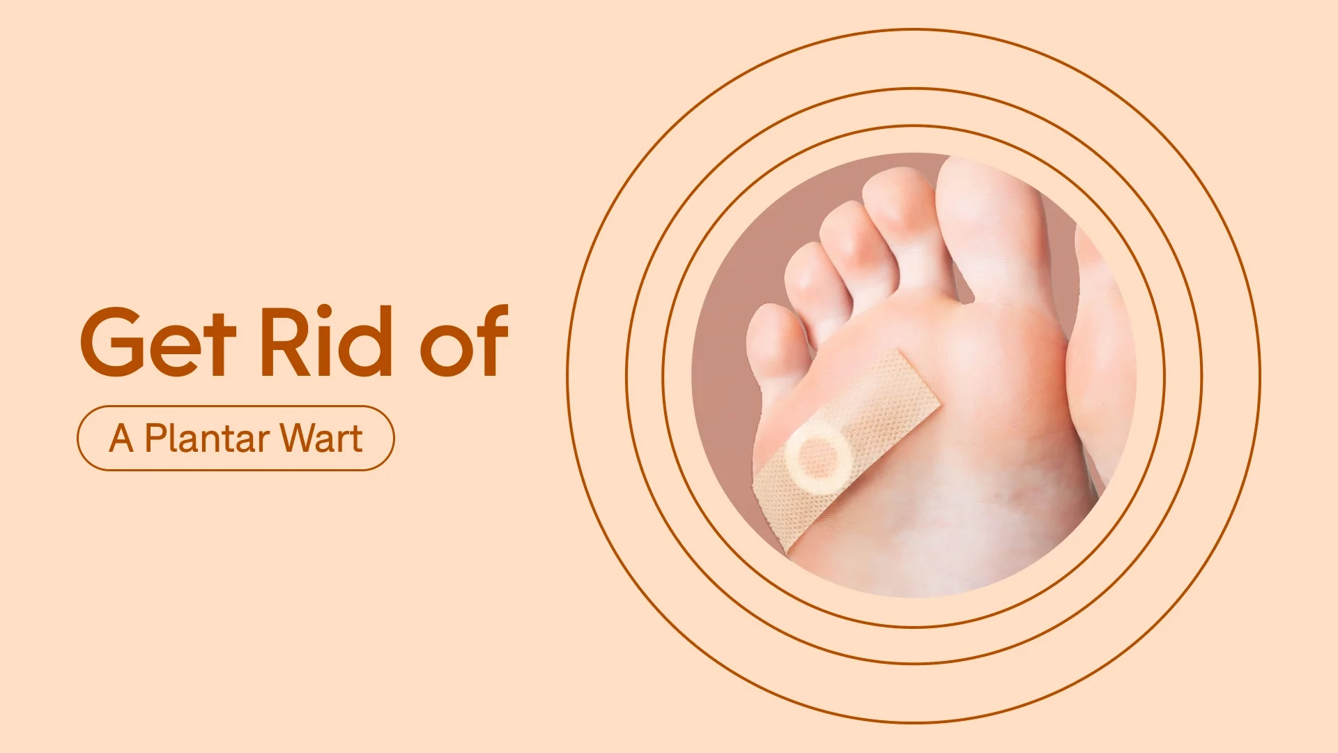 A custom graphic includes a photo of the bottom of a foot with a bandage on it and text that reads, “Get Rid of a Plantar Wart.”