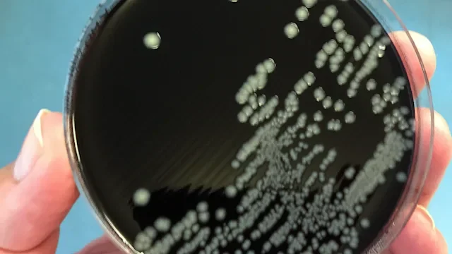 gastrointestinal-infection ꞉ GettyImages 588965116