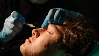Health: Facial wrinkles: closeup botox injection 1312349772