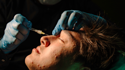 Xeomin and Botox Cosmetic injections both treat facial wrinkles, so what are the differences between them? Compare the cost and side effects of Xeomin and Botox.