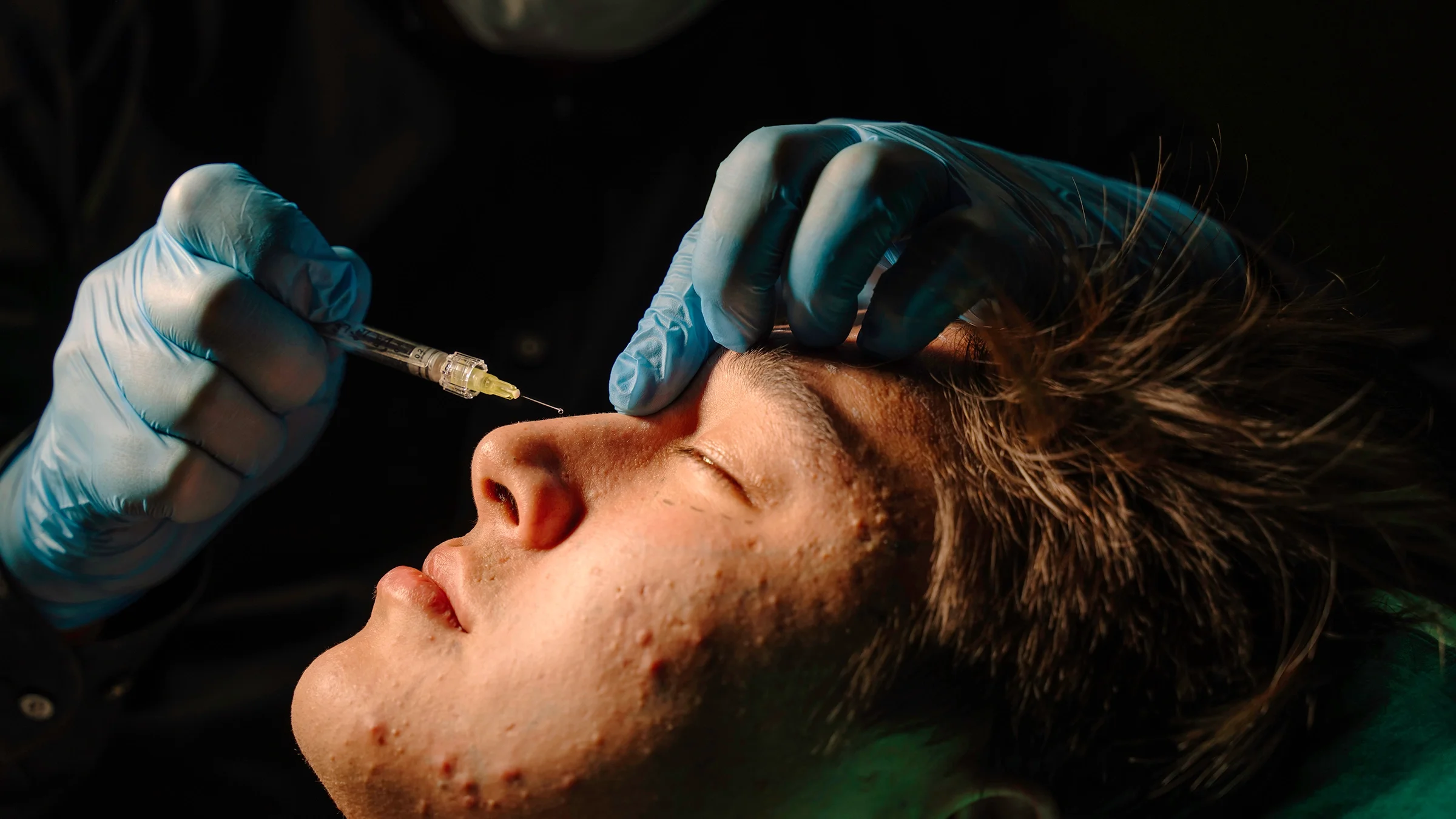 Close-up photo of a man getting Botox injections. It's dimly lit and very dark around his face.