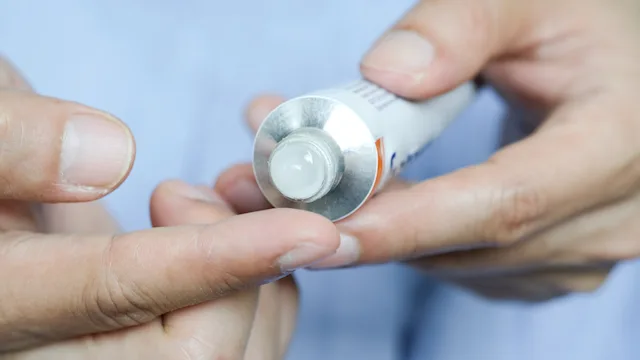 What Does Topical Steroid (Corticosteroid) Potency Mean?