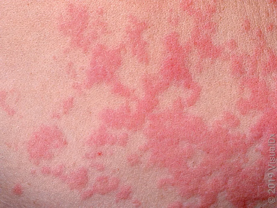 Hives of different shapes and sizes.