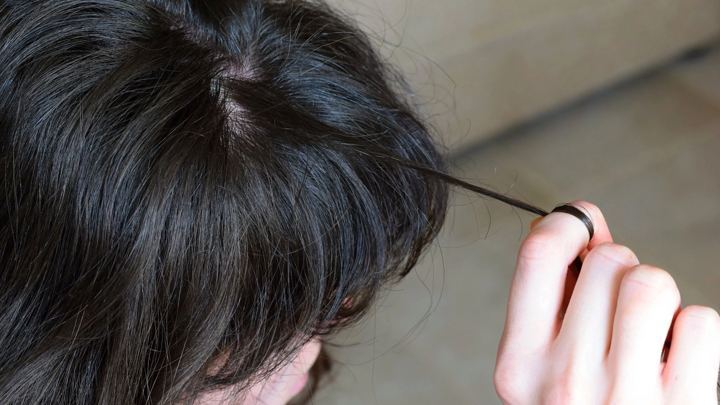 A woman pulls her hair. Trichotillomania is a condition in which a person has an obsessive desire to pull hair out.