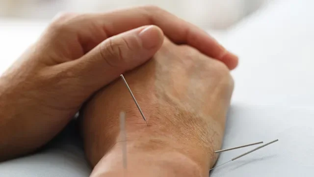 closeup hands with acupncture needles 937168200