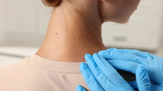 Dermatology: closeup skin examination 2266260134