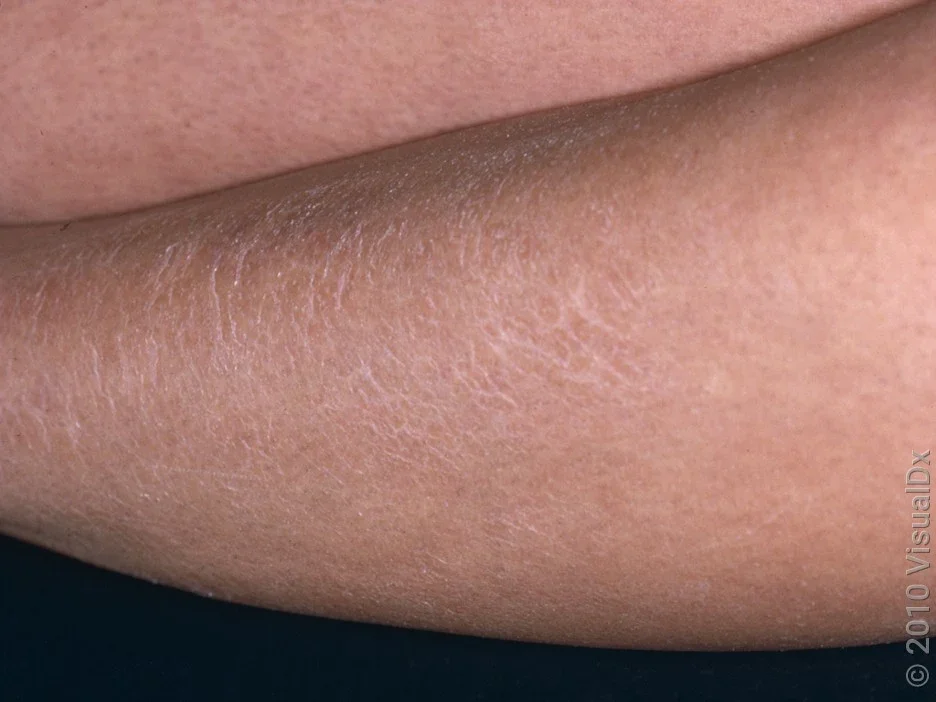 A close-up look of dry skin on the leg. 