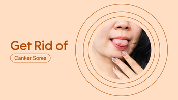 Dermatology: Get Rid of Canker Sores: rid featured image