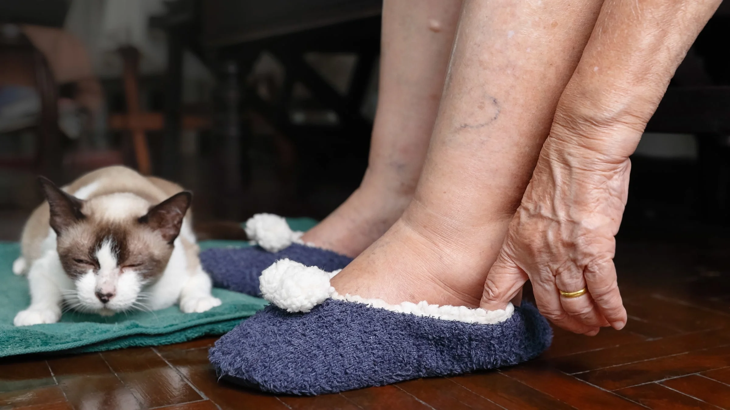 A person putting on fluffy slippers on swollen feet. Their cat is sleeping on the floor next to them.