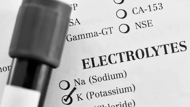 Health: hyperkalemia: GettyImages 1172555637 BW