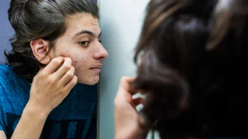 Dermatology: looking at acne in mirror 1324430642