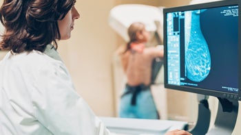 Breast cancer: Grading: doctor examining breast mammogram on screen patient in background 1128870494