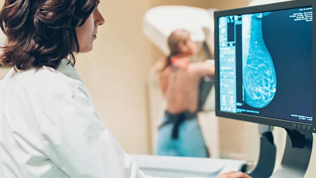 Breast cancer: Grading: doctor examining breast mammogram on screen patient in background 1128870494