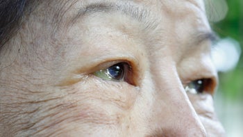 hepatitis c : GettyImages 1173706124