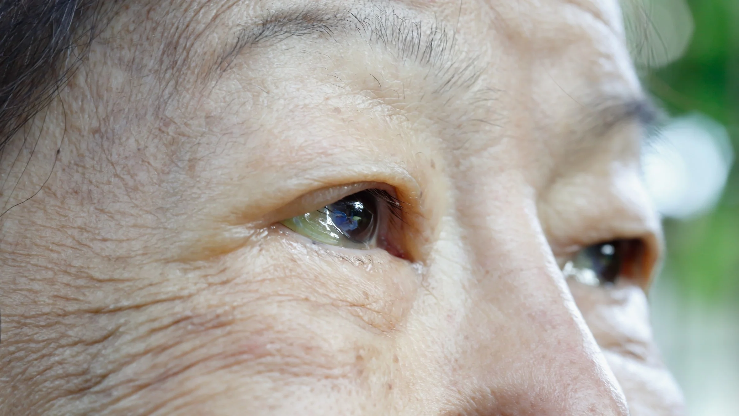 An extreme close-up cropped shot of an older adult’s eyes.