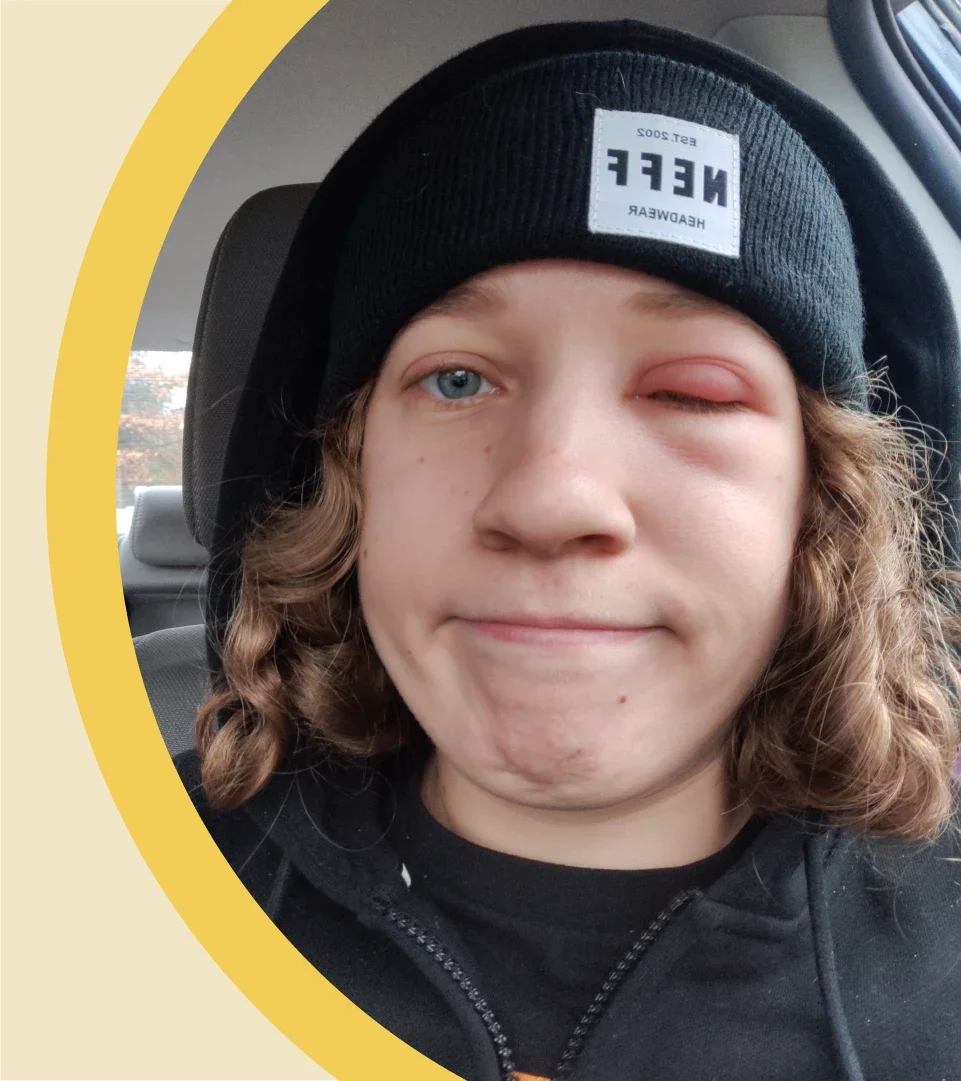 Health: Patient experiences: medicine cabinet blepharitis quote 2