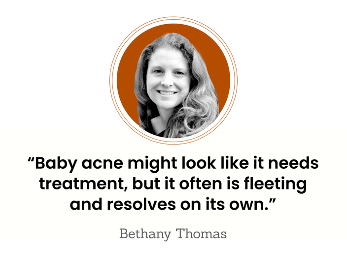 This is a photo of Bethany Thomas. “Baby acne might look like it needs treatment, but it often is fleeting and resolves on its own.”