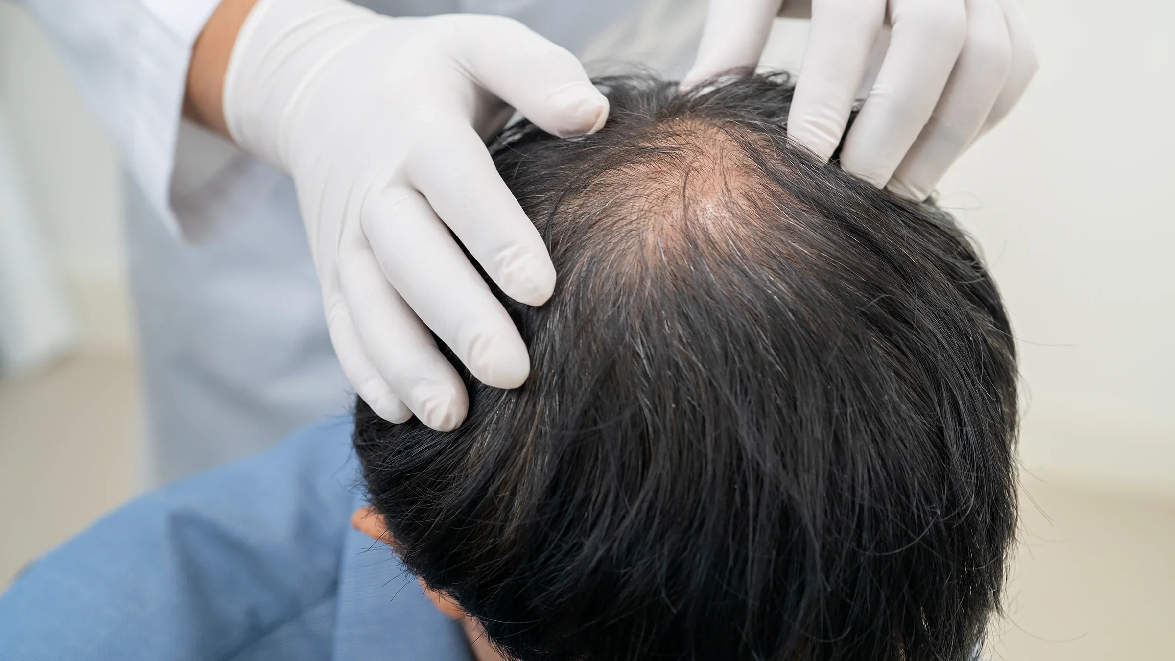 Close-up treatment for hair loss.