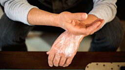 Psoriasis treatment may include topical medications and full-body treatments. Try these psoriasis creams and lotions to calm inflammation, scaling, and dryness.