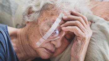 Eye: Post-cataract surgery: napping with eye shield after cataract surgery-1372174781