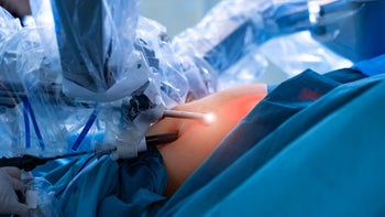 weight-loss: surgery: closeup surgery in progress-1217165078