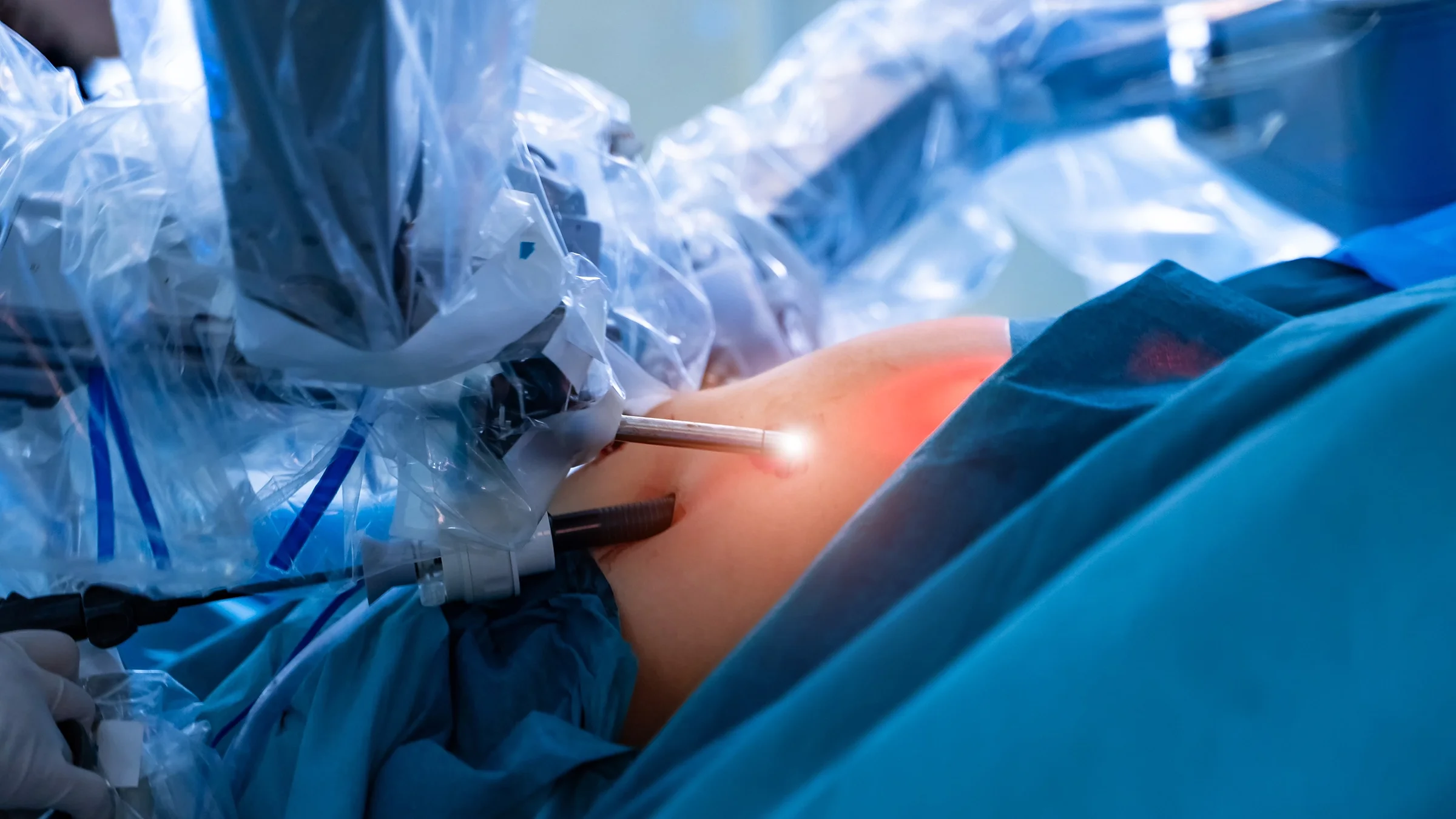 Close-up on a patient's abdomen before surgery begins.