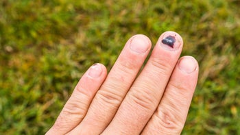 Health: musculoskeletal-conditions: GettyImages-497996088