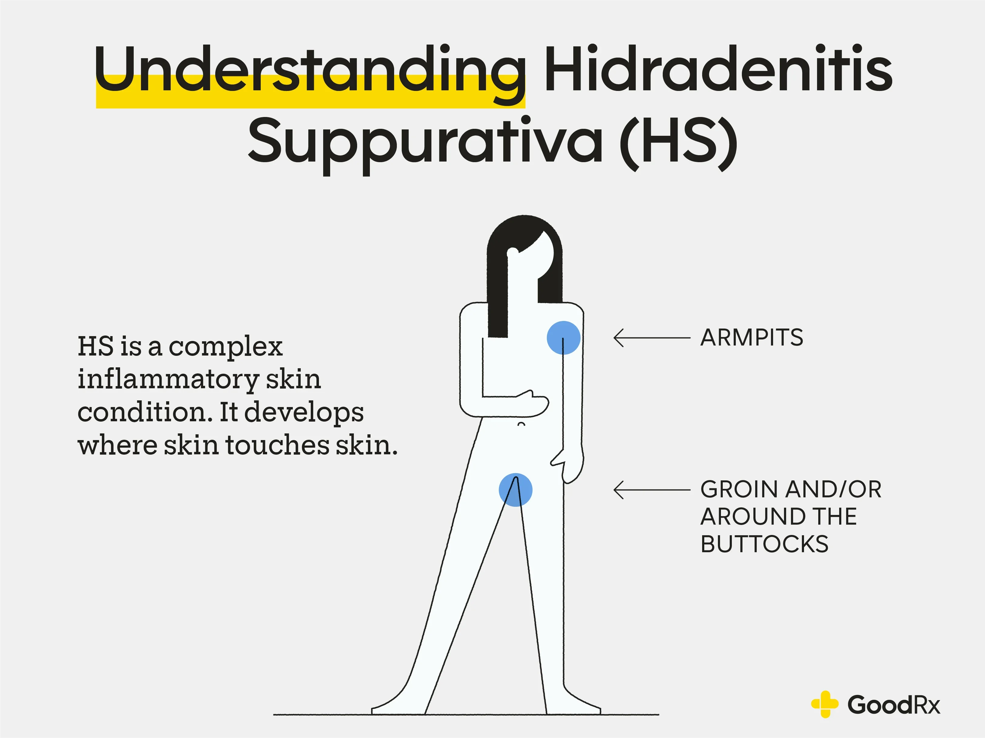 Understanding Hidradenitis Suppurativa (HS)