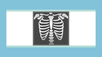 Blog banner: - X-ray
