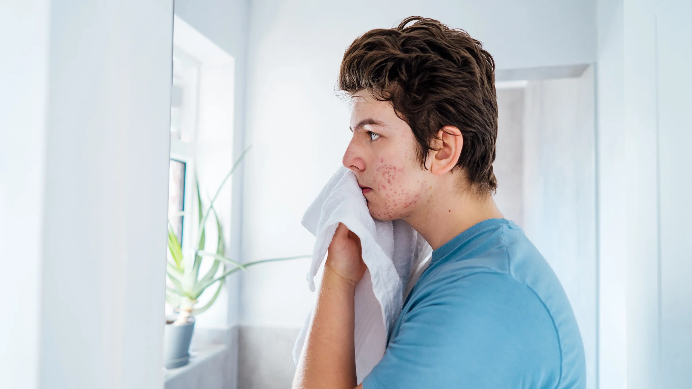 Teenage boy with acne problem wipes his face with a towel.