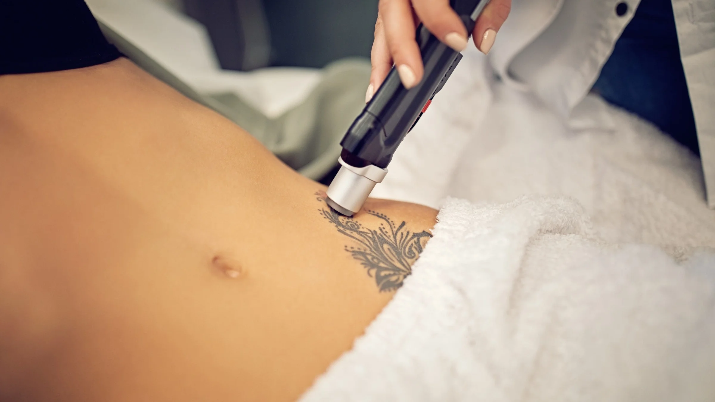 Close-up of a woman's abdomen with a large tattoo at the beginning of tattoo removal with a laser.