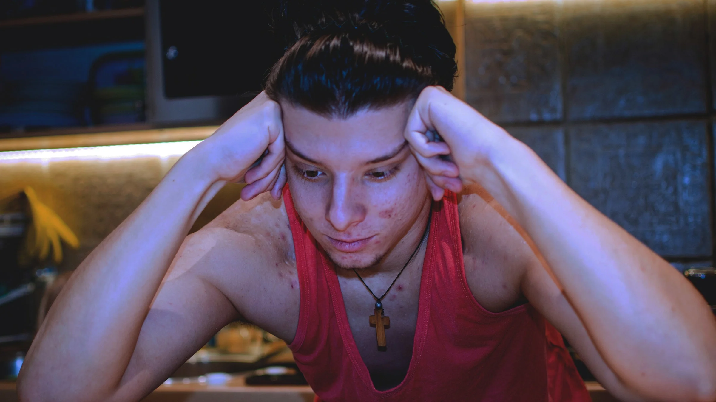 A person with acne looking depressed.