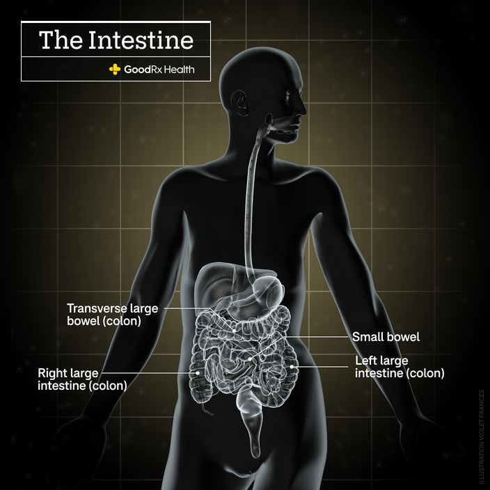 A 3D illustration of the intestine including transverse large bowel (colon), small bowel, right large intestine (colon), and left large intestine (colon). 
