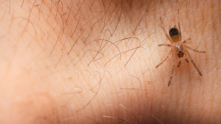 Close-up on a spider on a person's skin and hair.