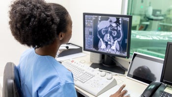 Renal Cancer: radiologist looking at scan 1487838053