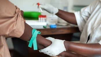 Liver: closeup patient blood test 508468215