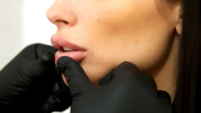 Dermatology: woman lip injections 2029561561