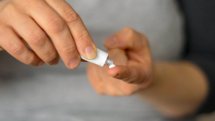 Close-up of a person using a prescription cream tube and applying a dollop on their finger.