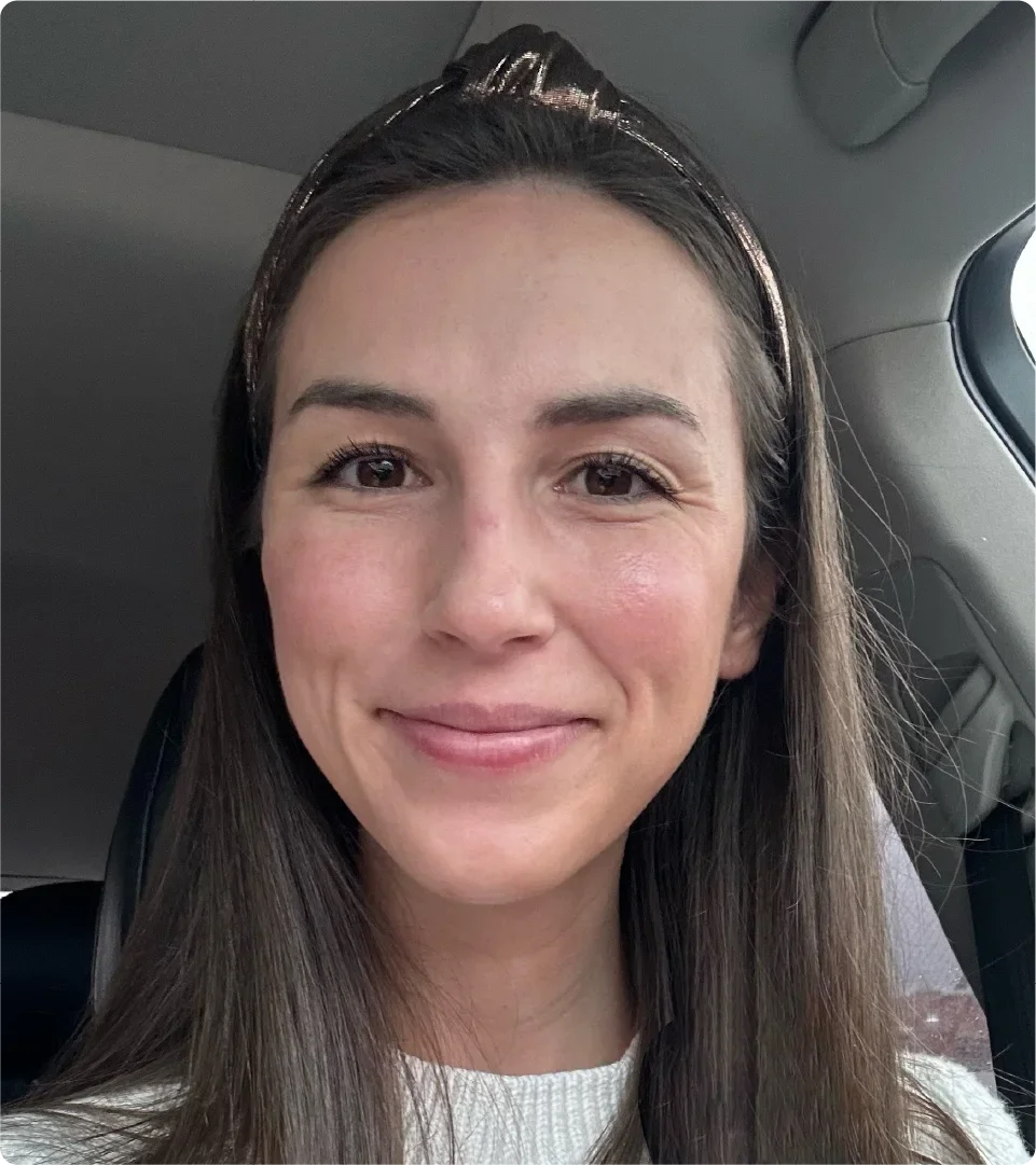 Jordan Bennie is pictured in a headshot after a pre-operation appointment.