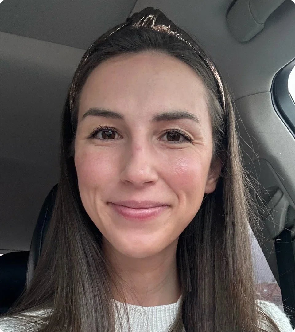 Jordan Bennie is pictured in a headshot after a pre-operation appointment.