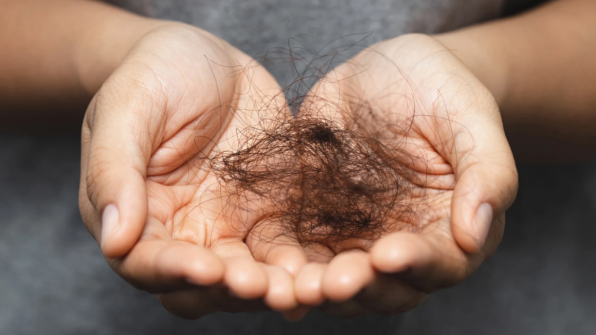 Handful of hair that has fallen out.
"Rattankun Thongbun"/iStock via Getty Images
