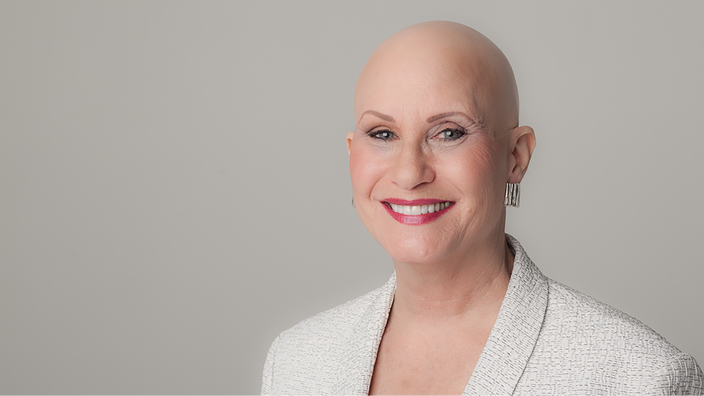 Living With Alopecia Areata Coming To