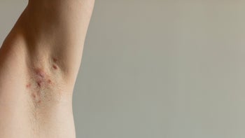 Health: shutterstock 1701645712