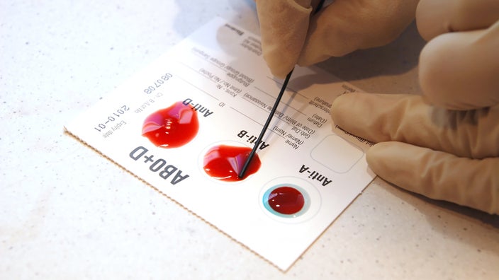 How to Determine Blood Type Without Test 