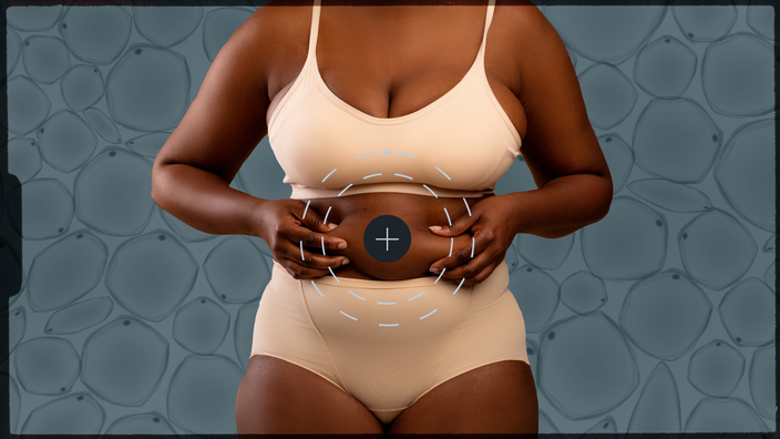 Blue-gray background with transparent overlay of fat cells. In the center is a cutout image of a woman’s torso where she is pinching her belly fat. On top of that is a callout graphic centered on the belly.