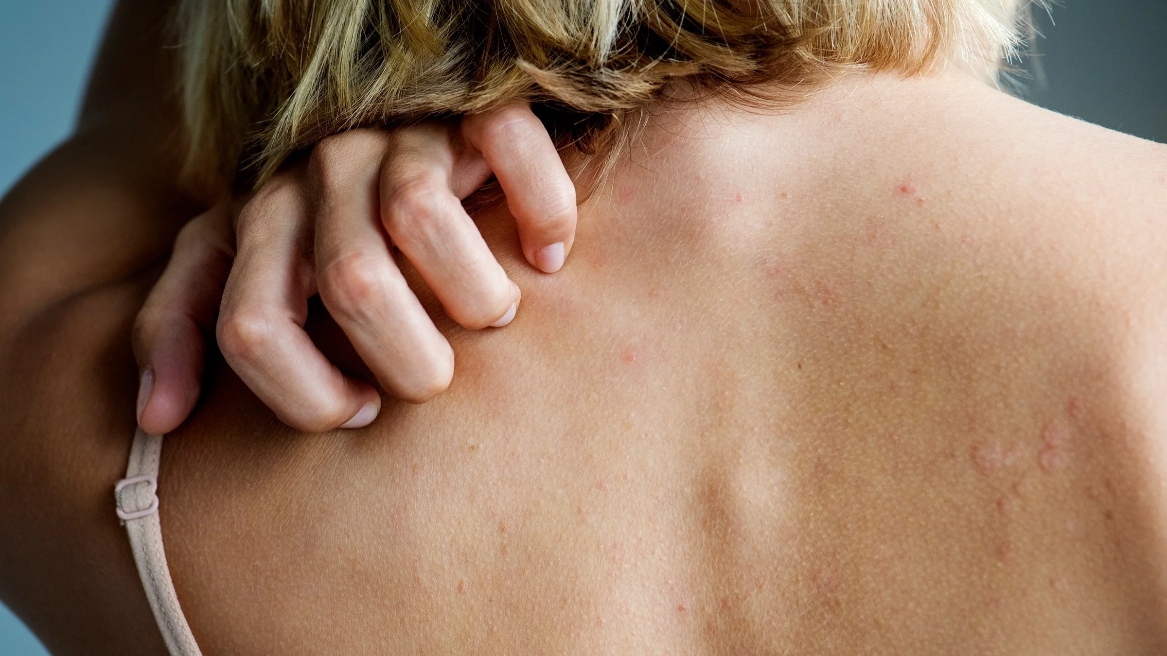 Cropped close-up of a woman scratching her upper back. She has short blonde hair and is wearing a tank top.